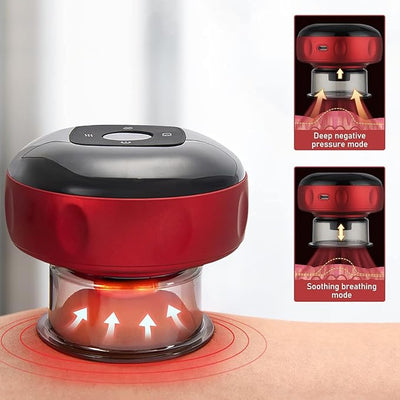 PRIMUS™Electric Dynamic Cupping Therapy Massager